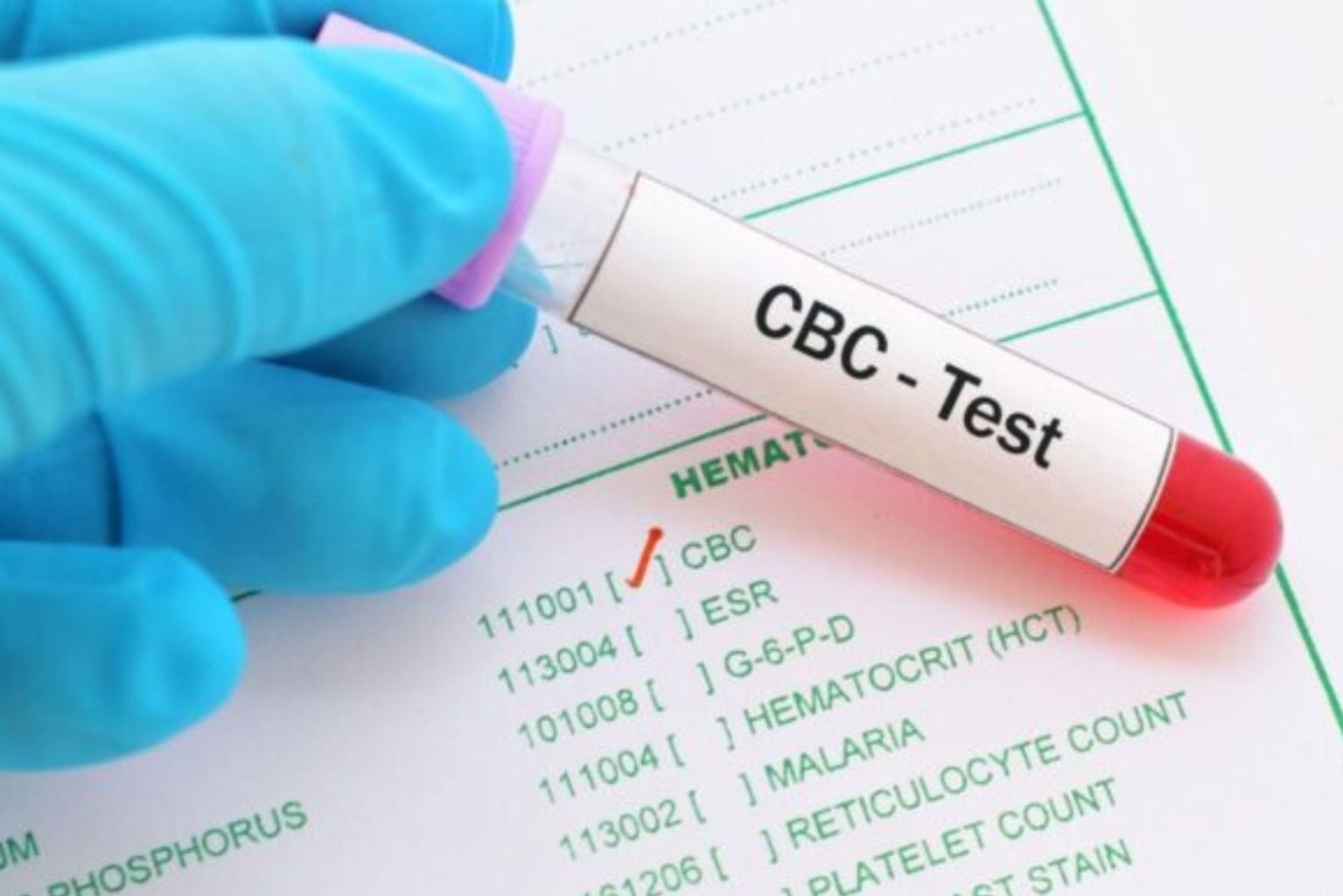 Understanding CBC A Essential Blood Test