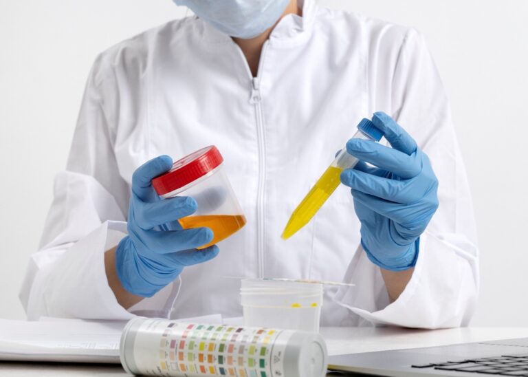 Know Your Urine Test: A Simple Guide for Everyday Health