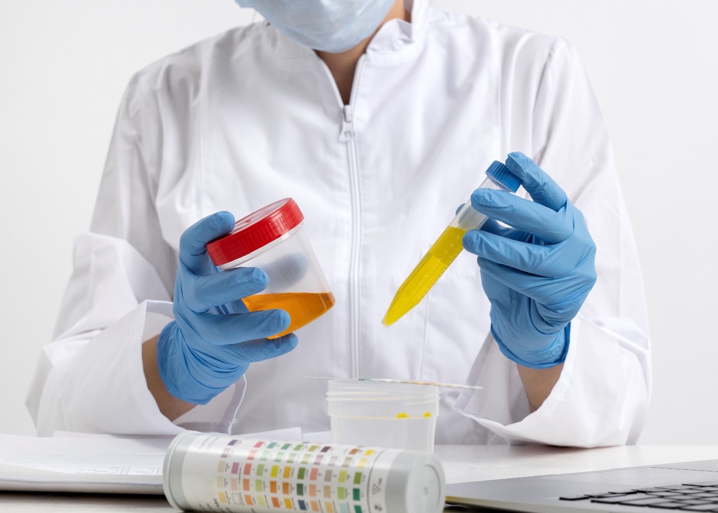 Know Your Urine Test: A Simple Guide for Everyday Health