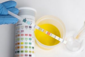 Know Your Urine Test: A Simple Guide for Everyday Health
