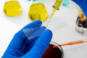 Know Your Urine Test: A Simple Guide for Everyday Health