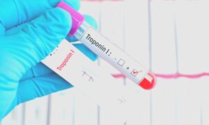 Cardiac hs Troponin I Test
