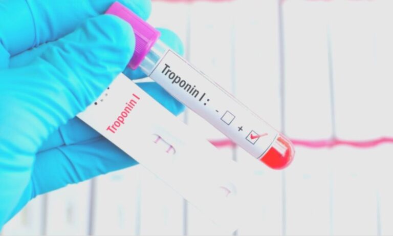 Cardiac hs Troponin I Test