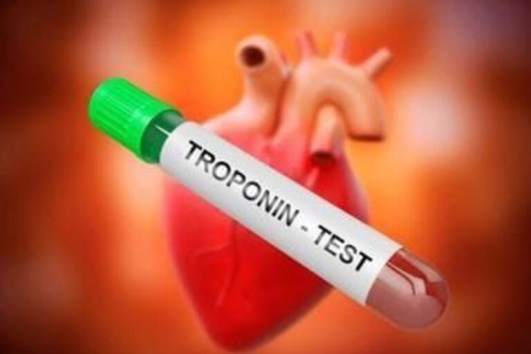 HS Troponin I Test The Lifesaving Heart Check You Should Know About