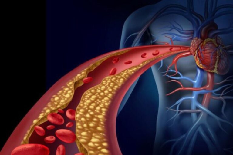 One Test, A Healthier Tomorrow The Cholesterol Story