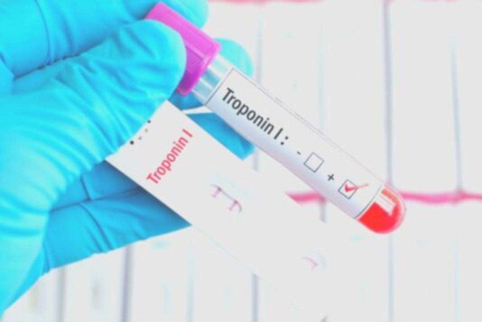 What Is the Cardiac hs Troponin I Test Early Detection of Heart Attack