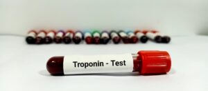 HS Troponin I Test: The Lifesaving Heart Check You Should Know About