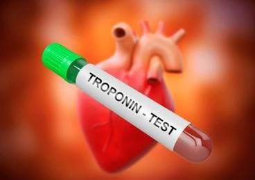 HS Troponin I Test: The Lifesaving Heart Check You Should Know About