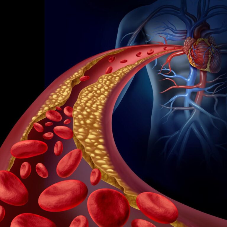 One Test, A Healthier Tomorrow: The Cholesterol Story