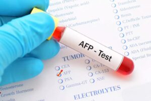 AFP (Alpha-Fetoprotein) Test: Purpose, Procedure & Normal Range Explained